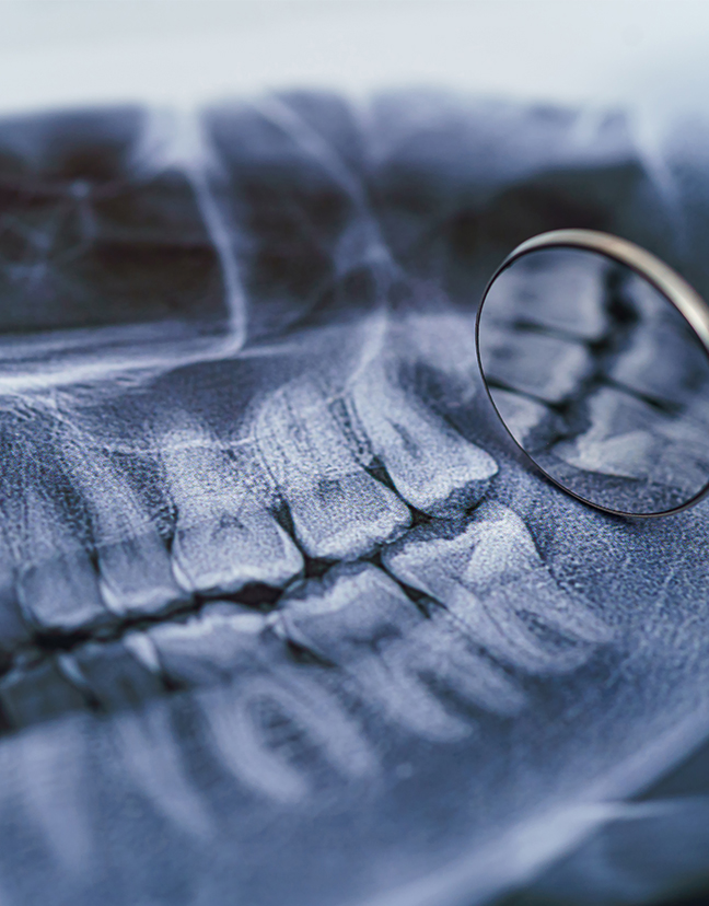 Treatment - Kensington Dental